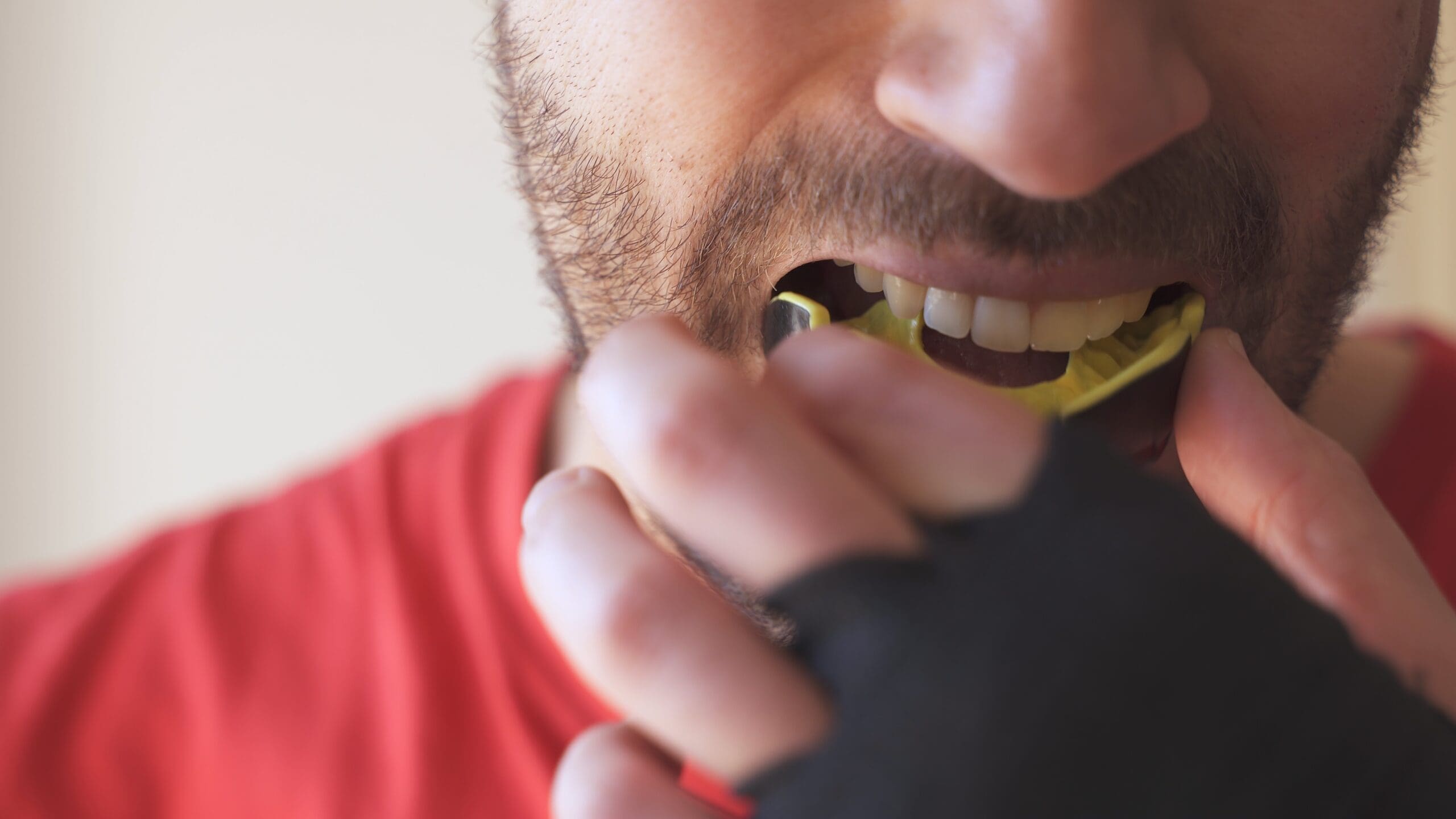 Custom Mouthguard Winter Springs, FL