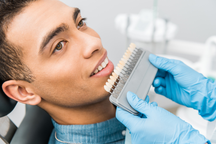 Porcelain Veneers vs. Dental Bonding